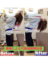 ヒデ整体院(Hide整体院)/猫背矯正骨盤矯正B/A肩こり腰痛