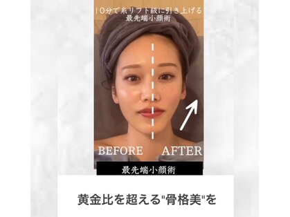 ルシエルの写真