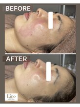 リノ 西宮北口店(Lino)/