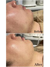 リブ(Lib)/今や男性お肌を綺麗にする時代♪