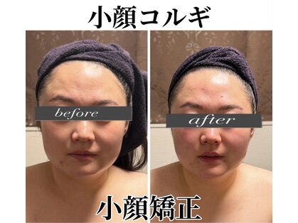小顔アンドエイジングケア専門店 ビゼ(美sser)の写真