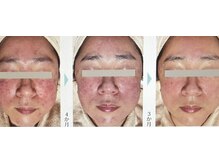 セラビシャン/before→after