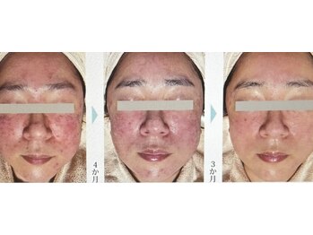 セラビシャン/before→after