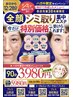 【チラシ】先着30名！全顔シミケア集中エステ(90分×2回)¥5,980