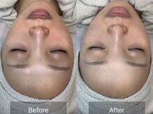 大人女子のためのたるみ改善サロン　Charmant【シャルマン】/