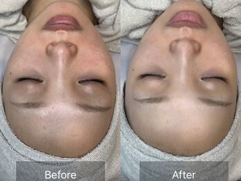 大人女子のためのたるみ改善サロン Charmant【シャルマン】/