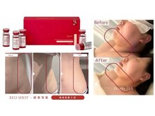 美ネージュの雰囲気(レッドショットでフェイスラインもボディラインも解決♪)