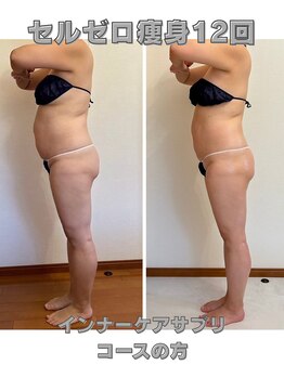 リミー(Re:Me)/40代〇〇さんの変化/半身