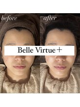 ベルバーチュプラス(Belle Virtue +)/カーボキシー