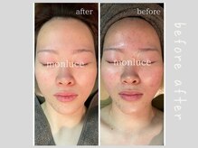 エステティック モンルーチェ(Esthetique monluce)