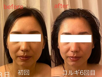 ビーキュート 神戸元町店(BE-CUTE)/コルギ6回目