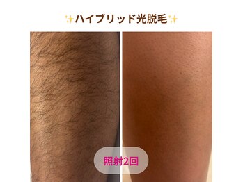 メリッサ(Melissa)