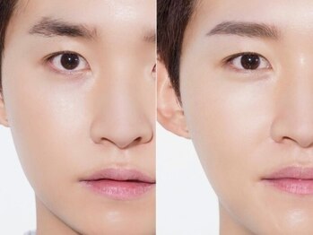 アルシスタ(ARCISTA)の写真/第一印象を底上げする“整う眉”へ。ビジネスもプライベートも清潔感と信頼感が自然と伝わる眉デザインを。