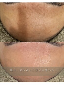 フットミー(foot mii)/つや肌