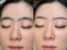 プリュームアイビューティー 銀座一丁目店/【Before&After】