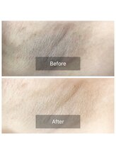 クレア(CREA)/美しいワキに…【ワキ美人】