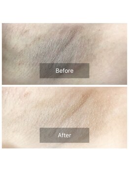 クレア(CREA)/美しいワキに…【ワキ美人】