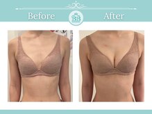 美人バスト 渋谷店/【バストアップ☆育乳】症例☆