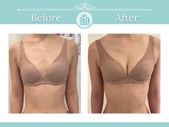 美人バスト 渋谷店/【バストアップ☆育乳】症例☆