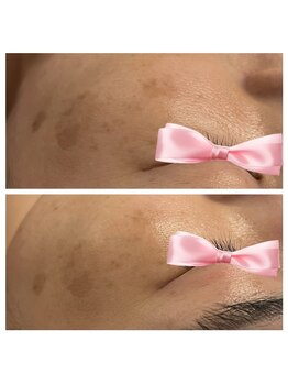 美温(mion)/マーメイド+はオプション