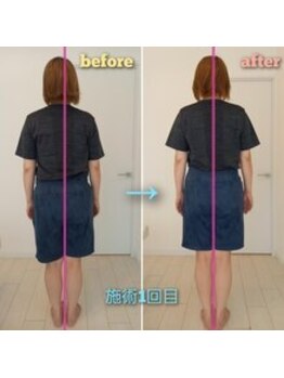 札幌ウィメンズ整体院/肩甲胸郭関節矯正