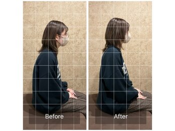 トラスト整体院 小池院/20代/女性/事務職/肩こり