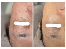 アルム(Areum)の雰囲気(継続でシミもしっかりケア!約2ヶ月での結果です♪)