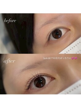 ビオラス(Biolus)/まつげパーマ/ラッシュリフト