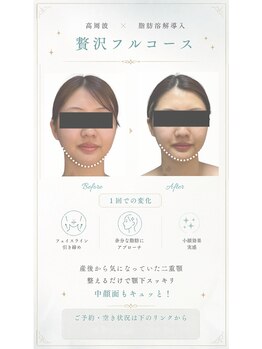 エフリア 大垣(F.lia)/中顔面短縮