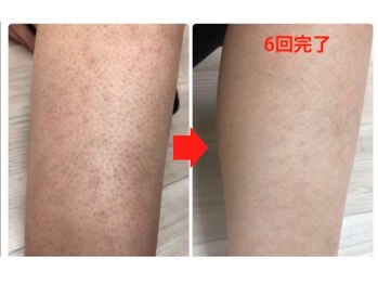 パールプラス 新倉敷店(Pearl plus)/BeforeAfter