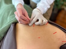 カイズ 日本橋人形町(KAIZ)/15種類の鍼からセレクト＊