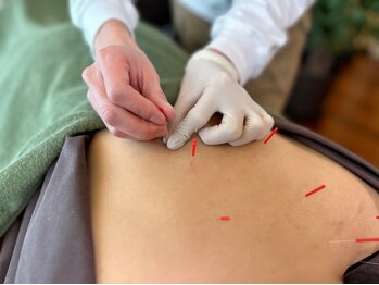 カイズ 日本橋人形町(KAIZ)/15種類の鍼からセレクト*