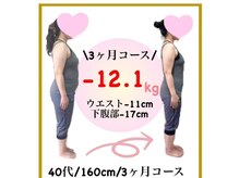 ビオ接骨院 大曽根院/何しても痩せなかった私が!!!