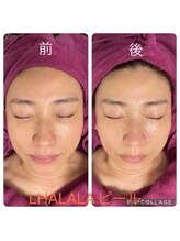 ビューティーサロン キャンディ 海老名(Candy)/