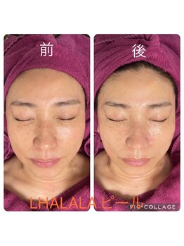 ビューティーサロン キャンディ 海老名(Candy)/