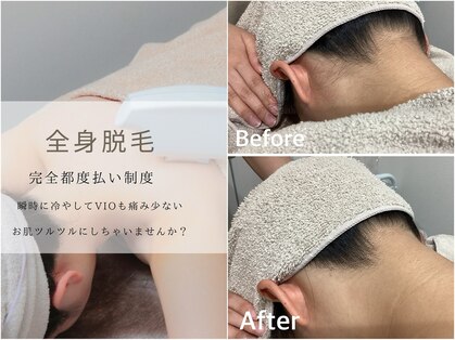 プルーラント エステ キョウト(Pullulant Esthe Kyoto)の写真