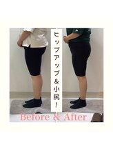 スタイルラボ高松/産後骨盤矯正の効果♪