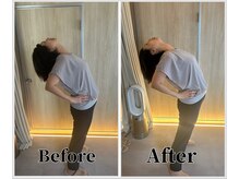 整体ラルース 中目黒(LALUZ)/50代　女性　猫背、姿勢改善