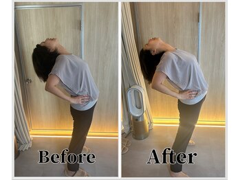 整体ラルース 中目黒(LALUZ)/50代 女性 猫背、姿勢改善