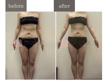 ノンノンプラス 博多(NON-NONプラス)/