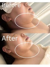 ミセル(MISEL2nd)/首のしわケアもお任せ★