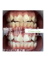 ホワイトニングサロン 札幌店/【ホワイトニング】#札幌#大通り