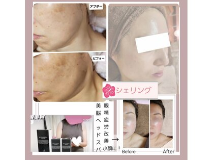 シェリングの写真