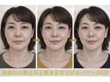 サロンチオリ 烏丸(Salon Chiori)/老化とたるみ肌改善の実例