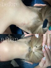 彩ビューティーラボ(彩 Beauty Labo)/脱毛