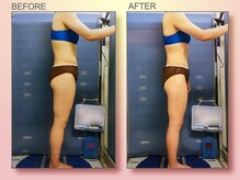 ジュリア オージェ 四条河原町店/ビフォーアフター（脂肪燃焼）