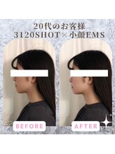 ラ セラフィータ 中目黒/【上級小顔】EMS美容液導入付き