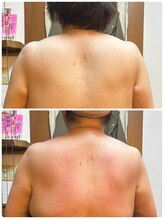 ハーモニー(Harmony)/四角い肩がストンと落ちる！