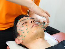 スタイル鍼灸整骨院/美容鍼！２