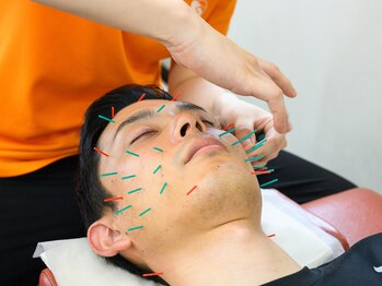 スタイル鍼灸整骨院/美容鍼！２